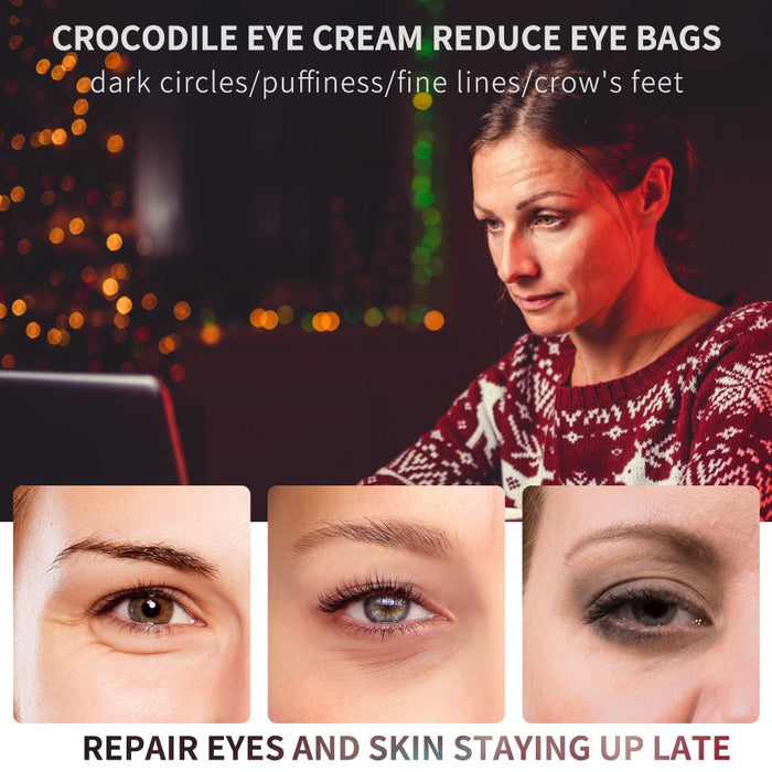 Eye Cream Peptide Collagen Serum Anti-Wrinkle Anti-Age Remove Dark Circles Eye Care Against Puffiness And Bags Hydrate Eye Cream-Health Wisdom™