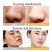 10pcs Black Sea Salt Moisturizing Bubble Facial Mask Deep Cleansing Oil Control Shrink Pore Skin Care Face Mask Black Masks-Health Wisdom™