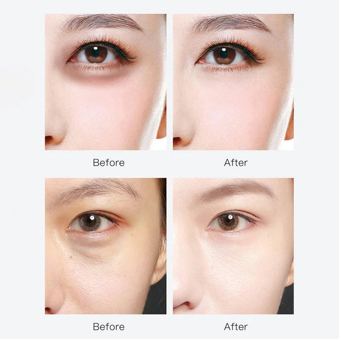 120pcs Hyaluronic Acid Eye Mask Moisturizing Anti-Wrinkle Anti Dark Circles Crystal Collagen Eye Patches Beauty Eyes Skin Care-Health Wisdom™