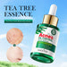 30ml Tea Tree Acne Removing Face Essence Oil Controlling Acne Printing Skin Care Product Moisturizing Facial Anti Acne Essence