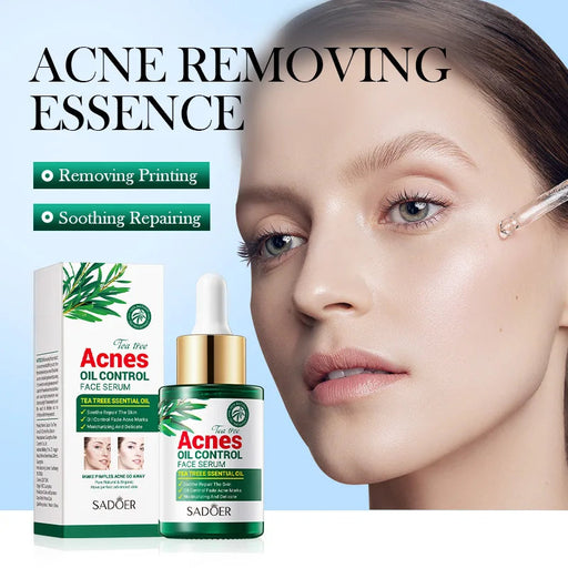30ml Tea Tree Acne Removing Face Essence Oil Controlling Acne Printing Skin Care Product Moisturizing Facial Anti Acne Essence-Health Wisdom™