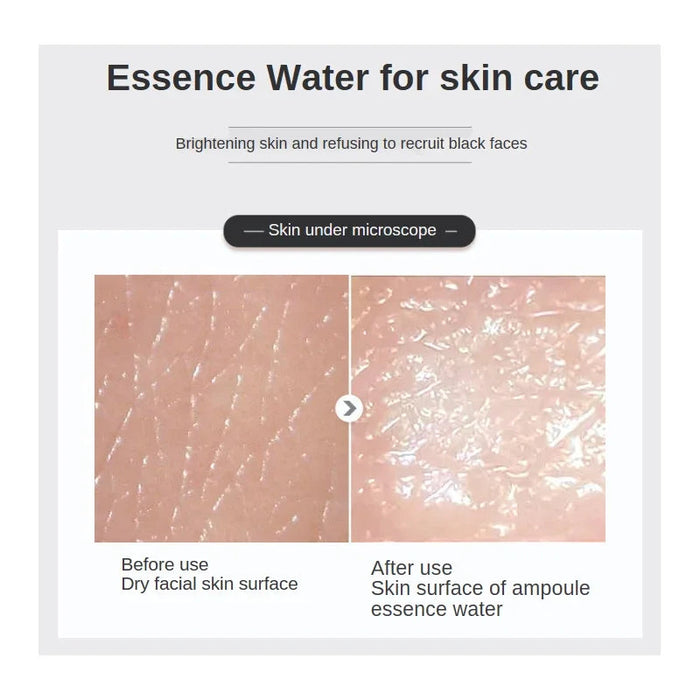 500ml Hyaluronic Acid Facial Essence Moisturizing Whiten Pore Shrink Anti-aging Freckle Anti Wrinkle VC Niacinamide Face Serum