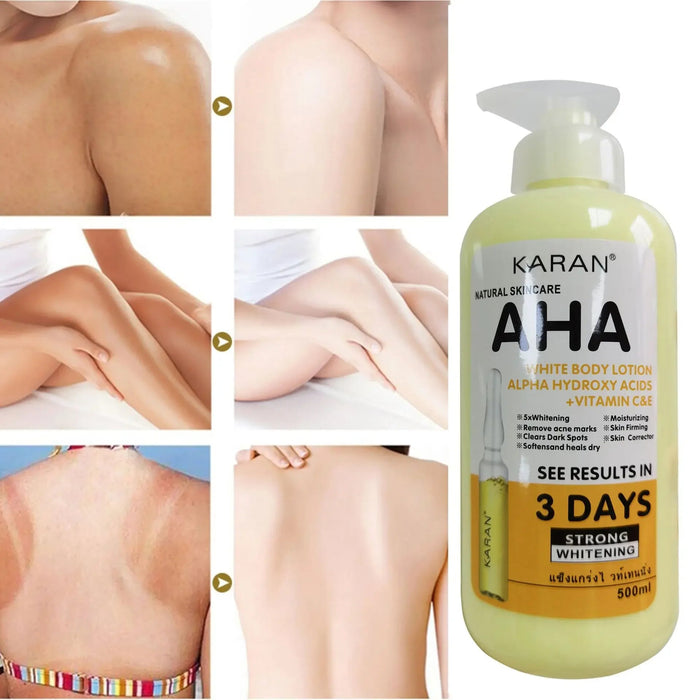 500ml Whitening Body Cream Hydroxy Acids Vitamin C&E Moisturizing Lightening Body Lotion Skin Care Remove Acne Marks