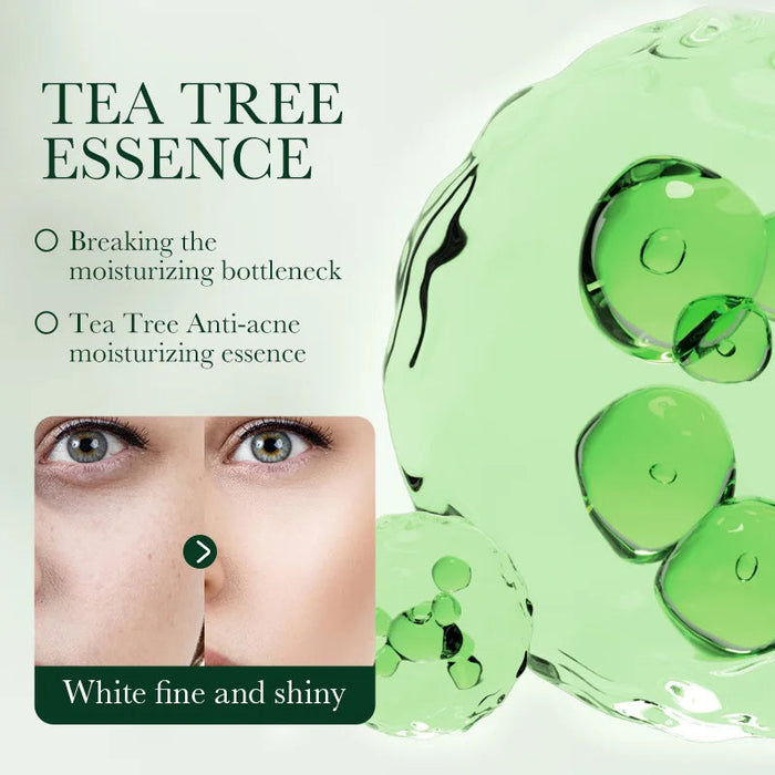 50g Tea Tree Acne Removing and Oil Control Face Cream Acne Printing Facial Anti Acne Skin Care Product Moisturizing Face Cream-Health Wisdom™