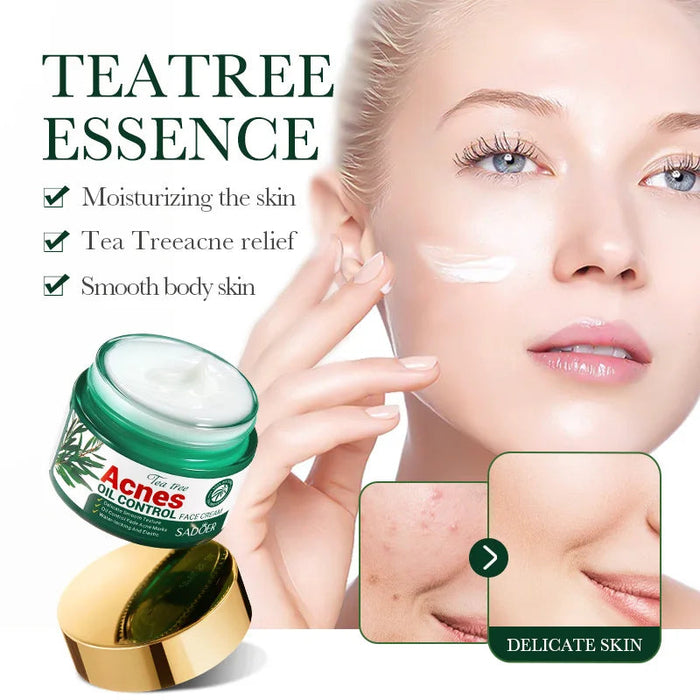 50g Tea Tree Acne Removing and Oil Control Face Cream Acne Printing Facial Anti Acne Skin Care Product Moisturizing Face Cream