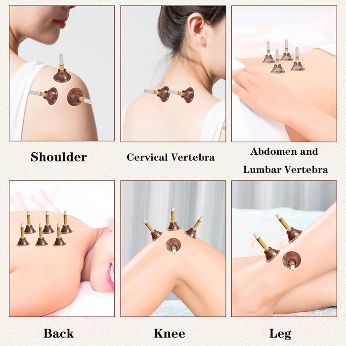 60Pcs Packing Moxa Stick Moxibustion Stickers Chinese Medicine Moxas Acupuncture Therapy Massager For Body Warm Uterus Stomach-Health Wisdom™