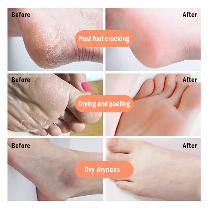 Anti Crack Foot Cream Oil Anti-Drying Crack Foot Cream Heel Cracked Repair Cream Removal Dead Skin Hand Feet Care Mask-Health Wisdom™