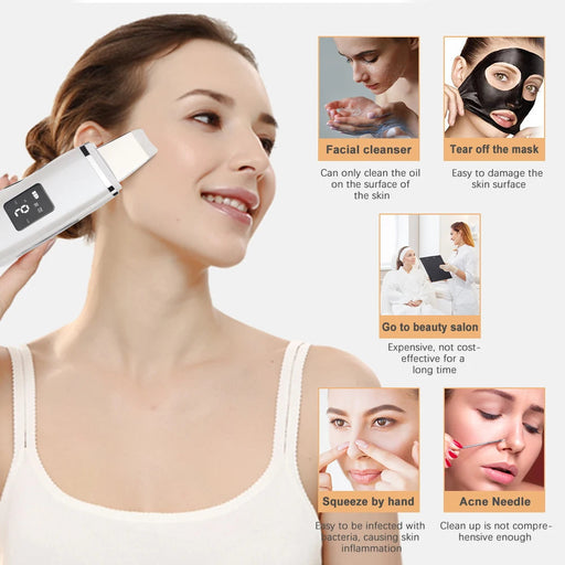 Ultrasonic Skin Scrubber Face Spatula Blackhead Remover Pore Cleaner Comedo Extractor Face Lift Devices Deep Cleaning Peeling-Health Wisdom™