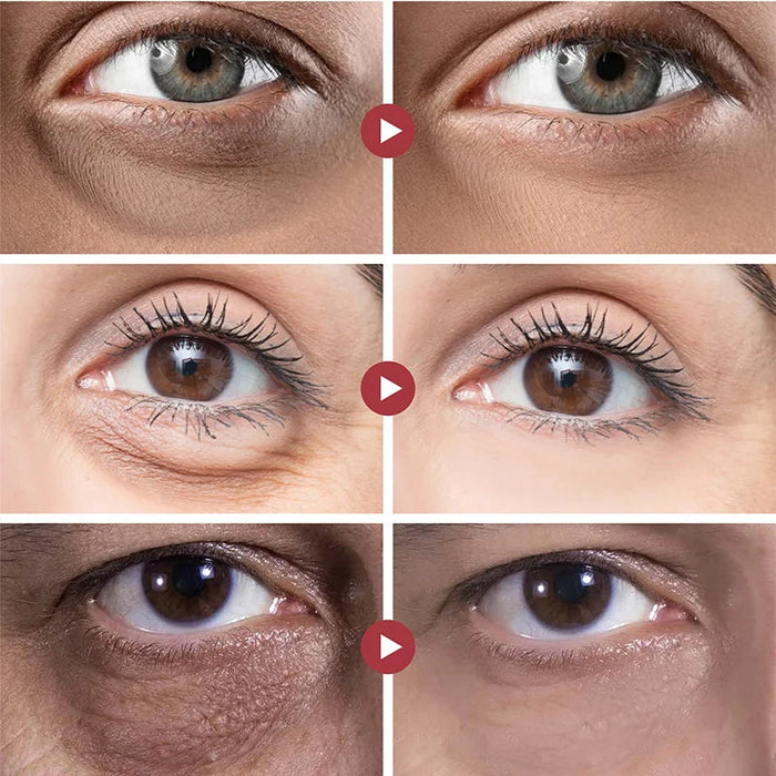 Vitamin C Eye Cream Anti Dark Circles Removal Eye Bags Puffiness Moisturizing Anti-Aging Firming Eyes Skin Care Prdoucts-Health Wisdom™