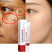 Whitening Freckle Cream Remove Melasma Cream Remove Dark Spots Melanin Melasma Remover Brighten Skin Anti-Aging Skin Lightening-Health Wisdom™